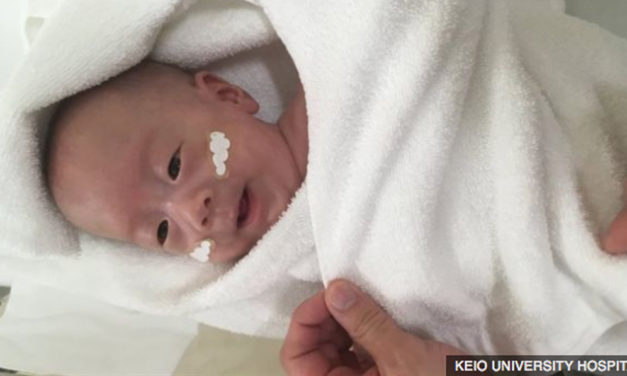 Smallest Baby Boy in the World Gets to Go Home
