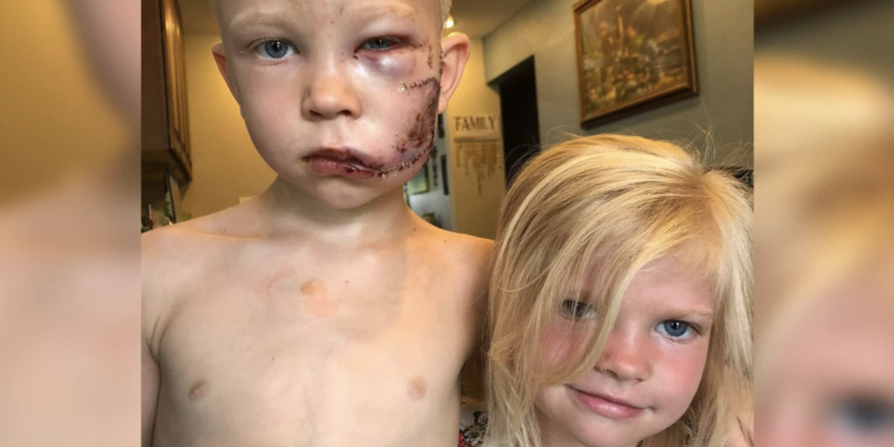 Six-Year-Old Saves Sister from Dog Attack, ‘If Someone Had to Die, I Thought It Should Be Me’