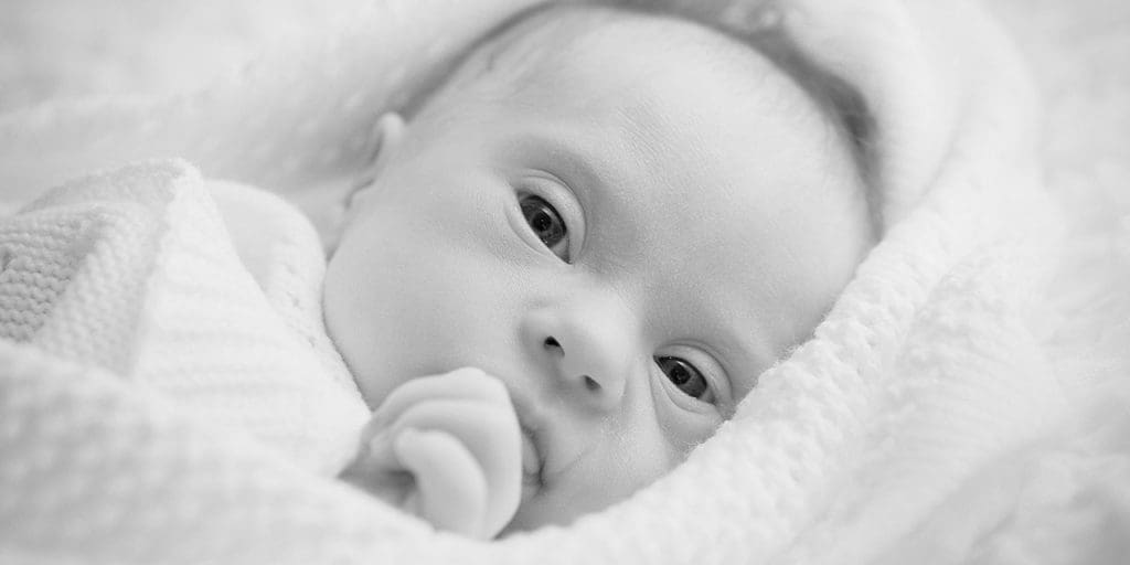 Baby with Down Syndrome