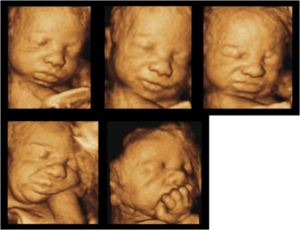 Multiple Ultrasound Pictures