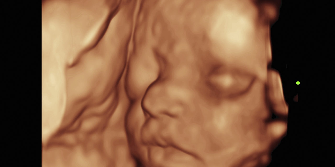 Supreme Court Shown Baby with 4D Ultrasound, Urged to Uphold Mississippi’s 15-Week Abortion Ban