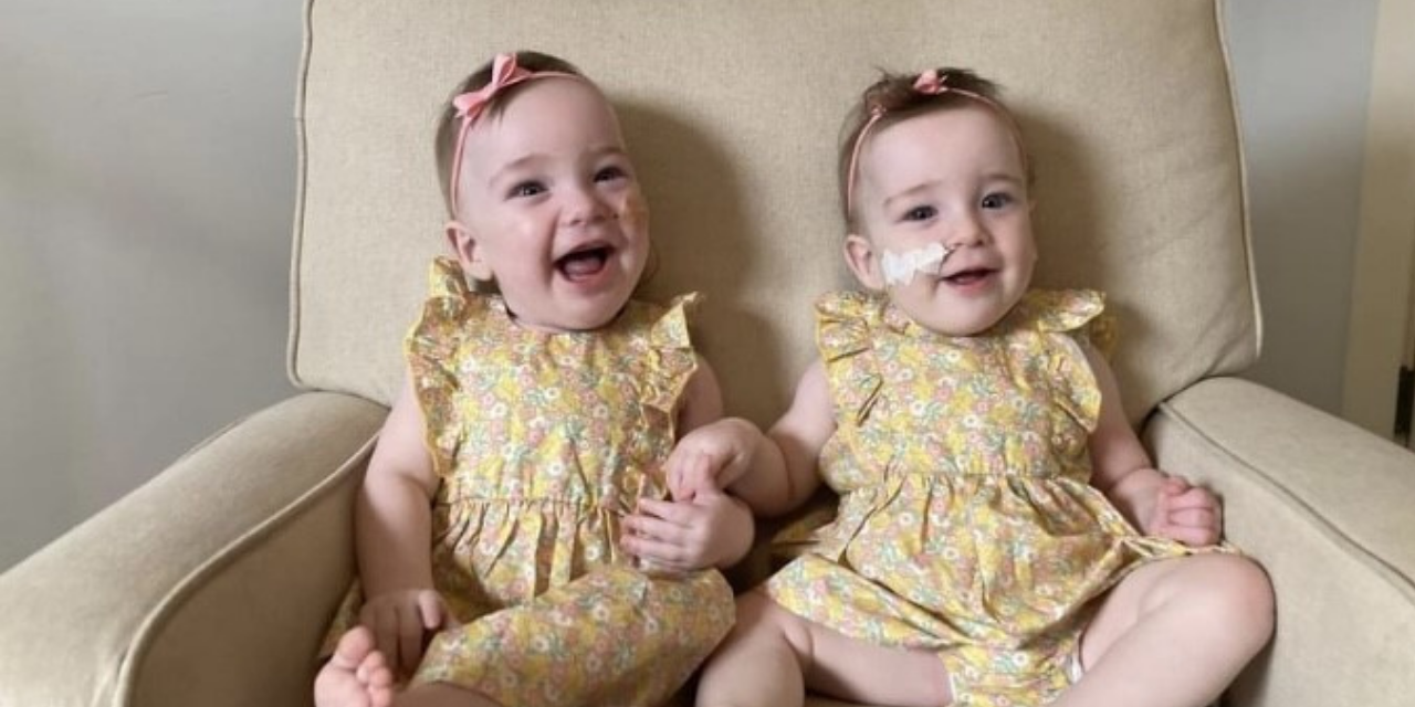Once Conjoined Twins Successfully Separated and Home From Hospital