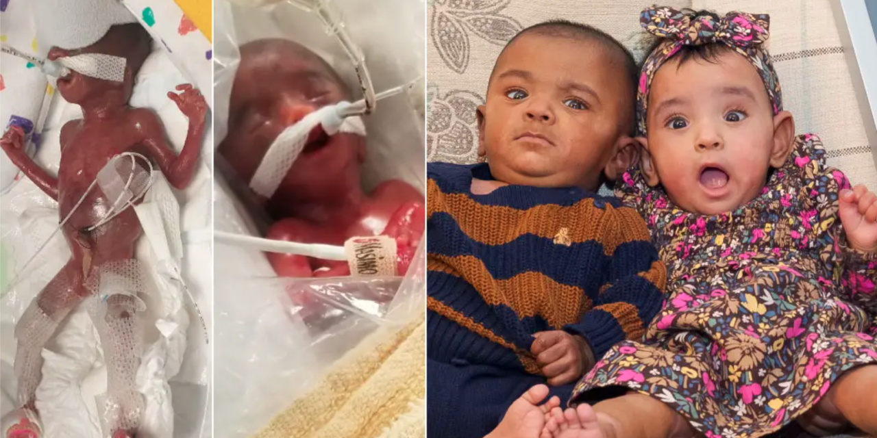 Babies With 0% Chance of Survival Become World’s Most Premature Twins to Live—Parents Give God All the Glory