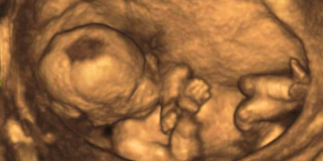 U.S. Senators Introduce Bill to Protect Aborted Babies from Medical Experimentation