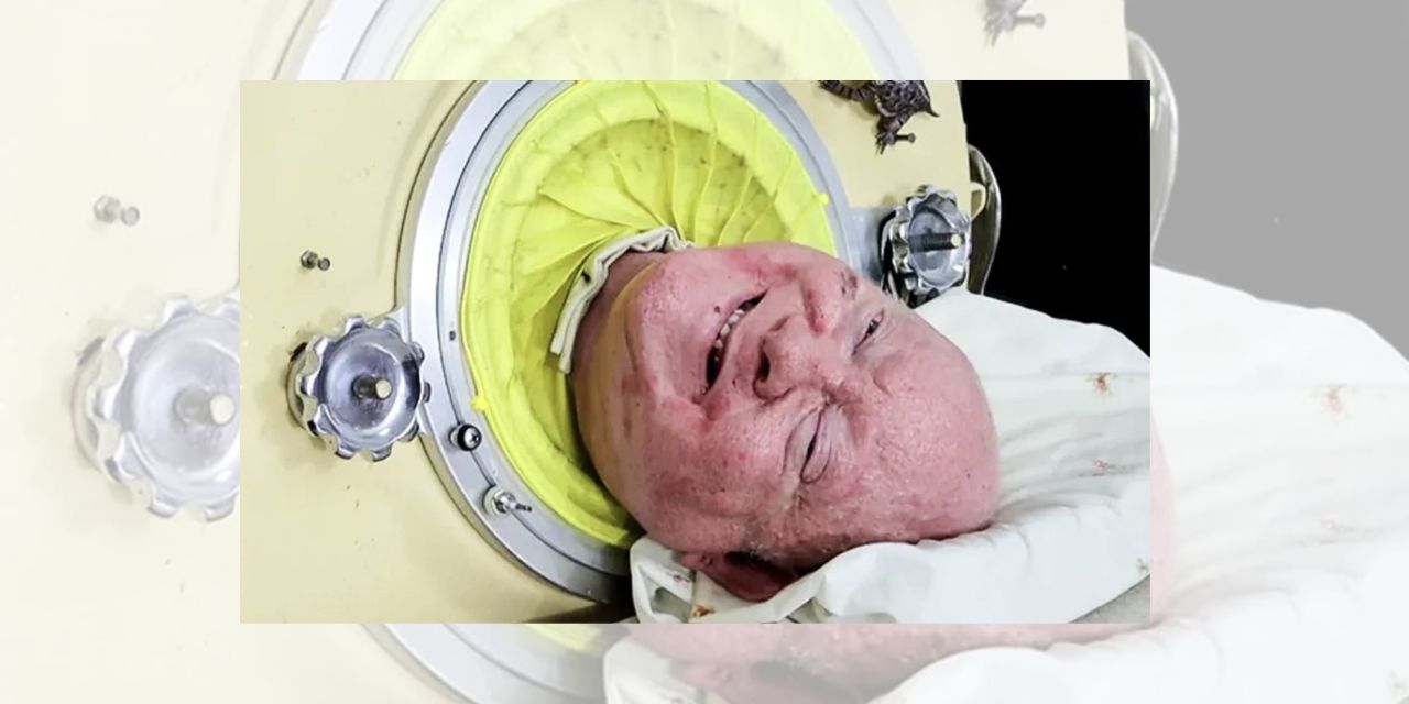 The Extraordinary Life of Iron Lung Patient Should Inspire and Convict Us All