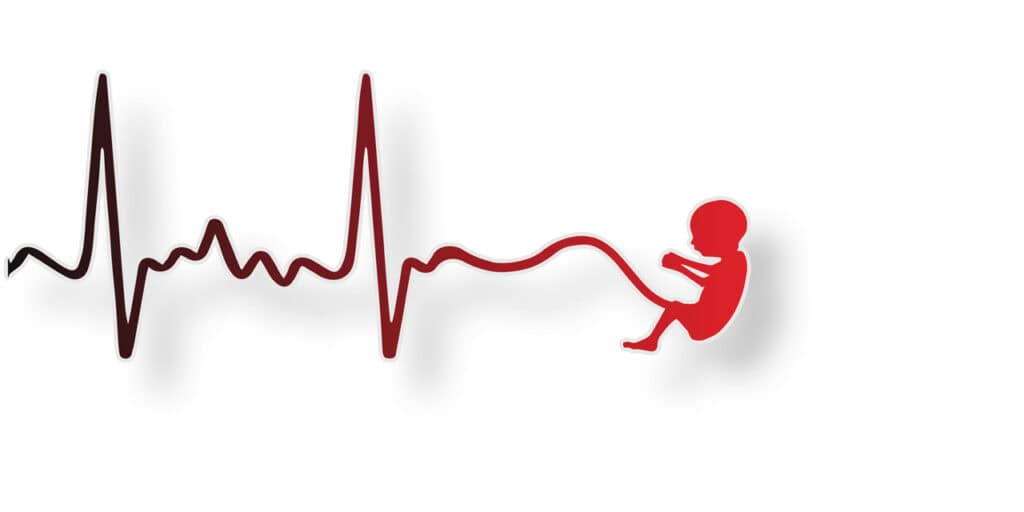 Heartbeat of a baby
