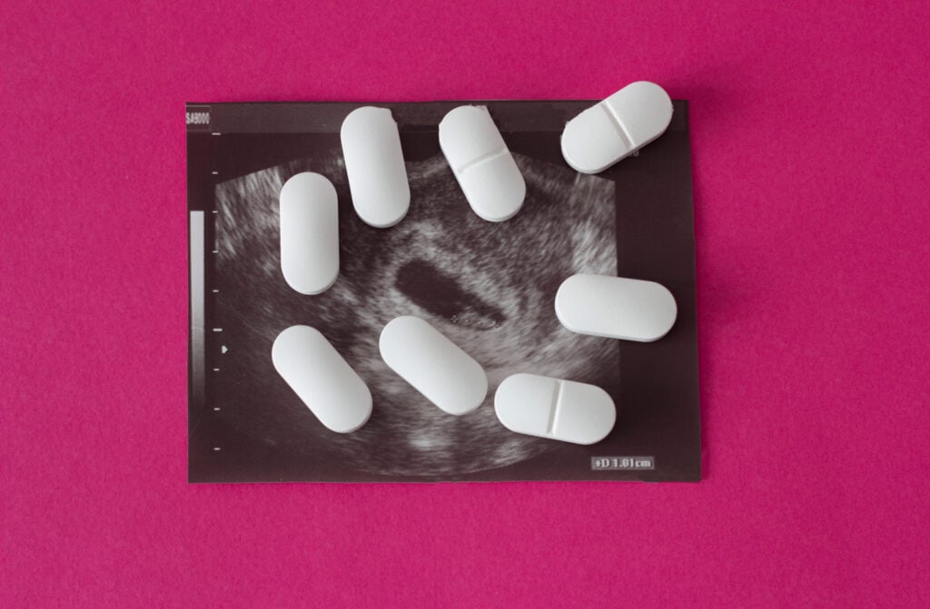 Abortion Pill|