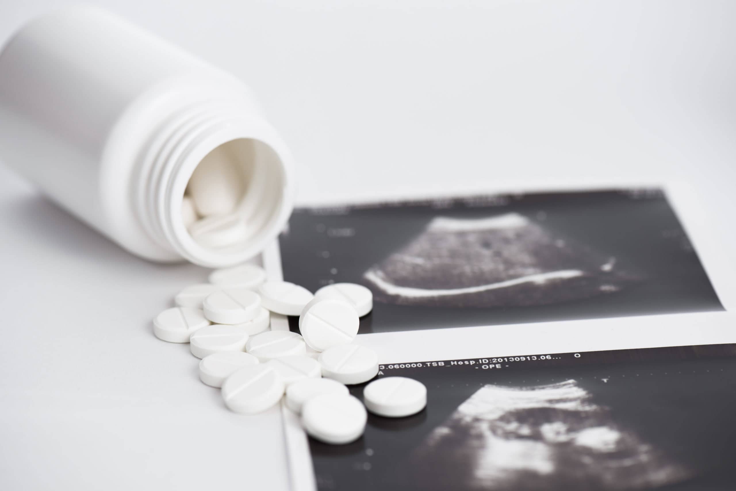 Ultrasound Picture and Pill