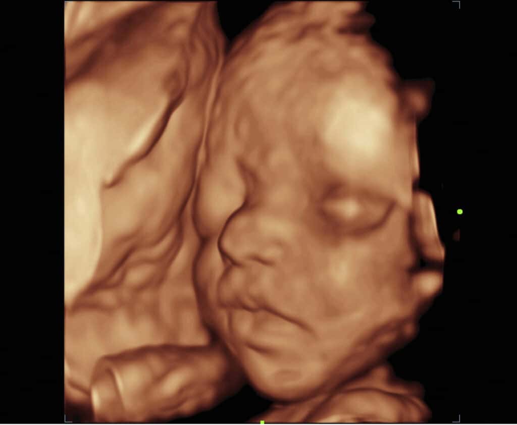 |Multiple Ultrasound Pictures