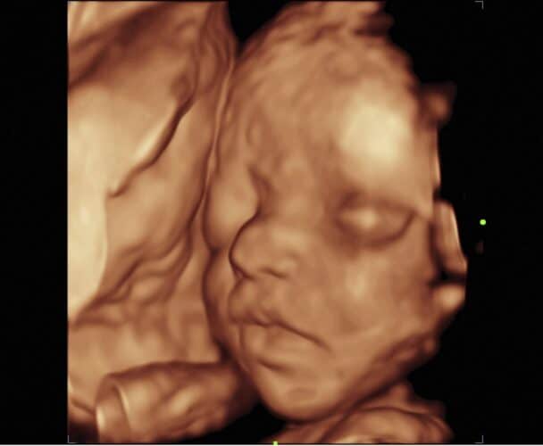 |Multiple Ultrasound Pictures